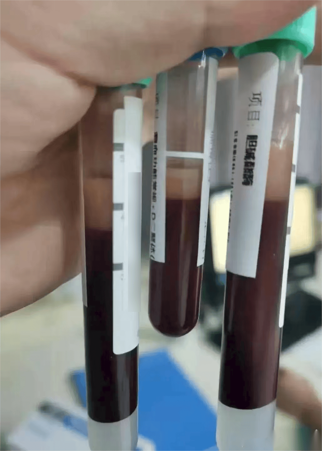 科尔多瓦vs卡斯迪隆_一口气干掉5只科尔多瓦vs卡斯迪隆,宁波男子被连夜送急诊!正大量上市!医生提醒:一次别超过2只