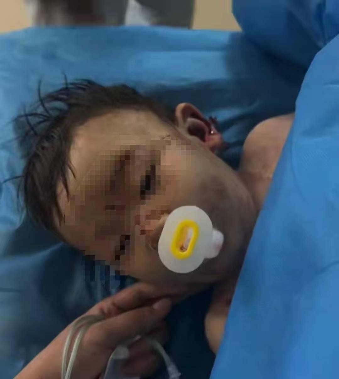 Hga030app_充气滑梯倾倒10人受伤Hga030app，包头2岁男童“睁眼性昏迷”已2个多月，当地披露事故原因