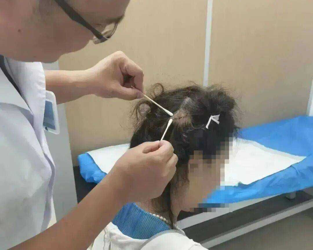 皇冠信用网在线开户_杭州一女子开车等红灯被追尾皇冠信用网在线开户,后脑勺鲨鱼夹撞稀碎